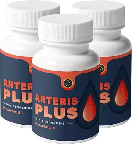 Arteris Plus